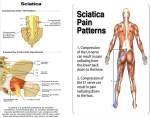 Sciatica pain pic pranic healing